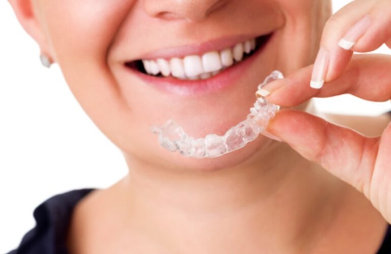 Invisalign cost North Sydney